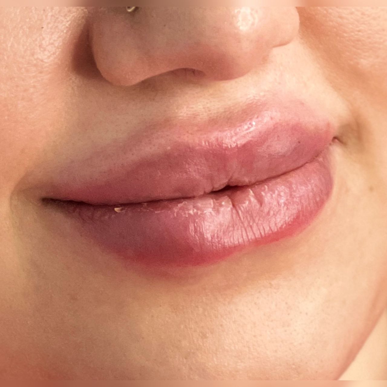 کلینیک زیبایی دکتر سپیده محمدی در تهران برای رضایت مشتریان خود چه اقداماتی را انجام میدهد؟