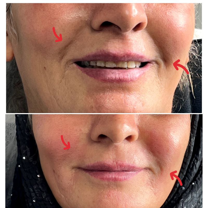 نتایج طبیعی و ماندگار