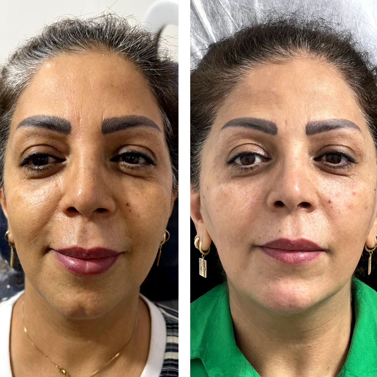 تیم حرفه‌ای و مجرب