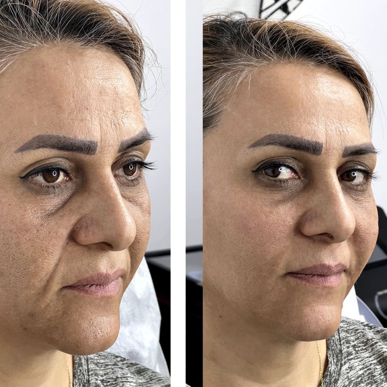 بهترین مواد و تجهیزات